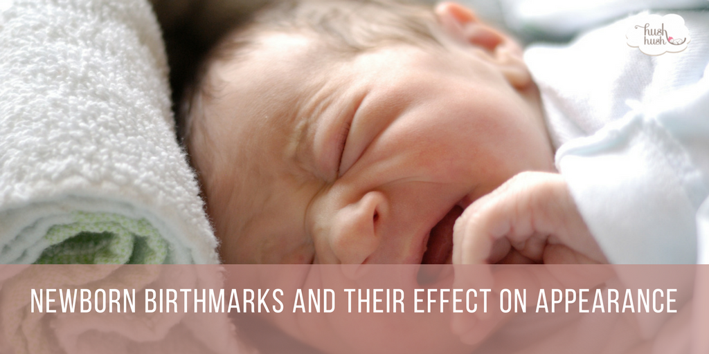 Newborn Birthmarks and Their Effect on Appearance